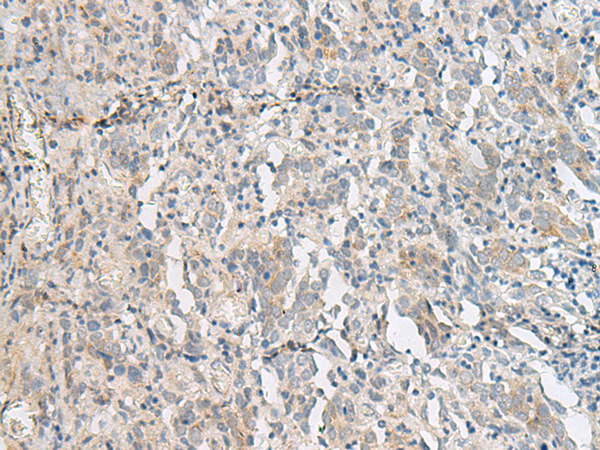 Rabbit Polyclonal Antibody to PCSK5