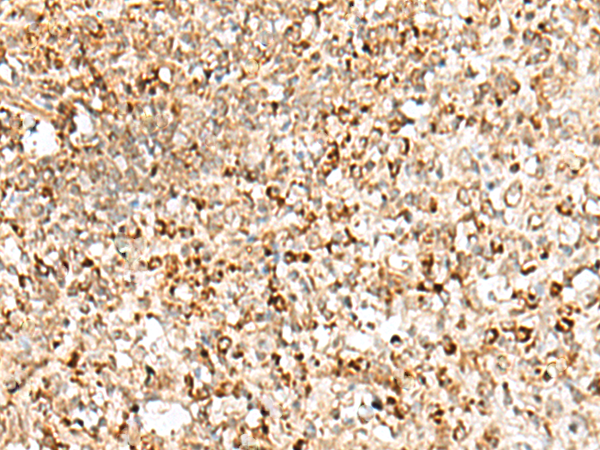 Rabbit Polyclonal Antibody to TEX11