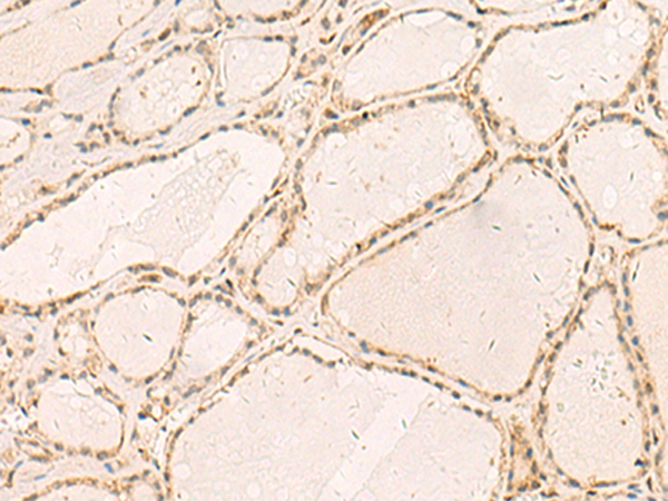 Rabbit Polyclonal Antibody to RFX6