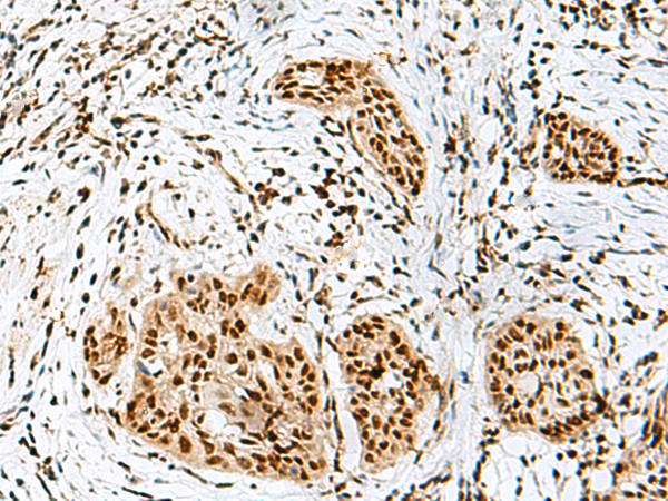 Rabbit Polyclonal Antibody to RBM10