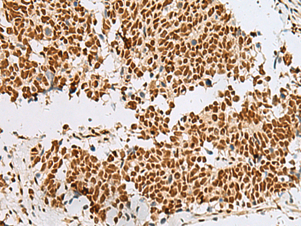 Rabbit Polyclonal Antibody to RBM12