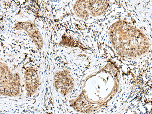 Rabbit Polyclonal Antibody to RBM15