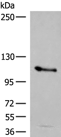 Rabbit Polyclonal Antibody to AP2B1