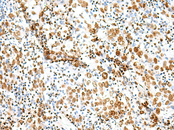 Rabbit Polyclonal Antibody to TCOF1