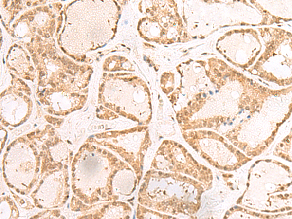 Rabbit Polyclonal Antibody to RBM19