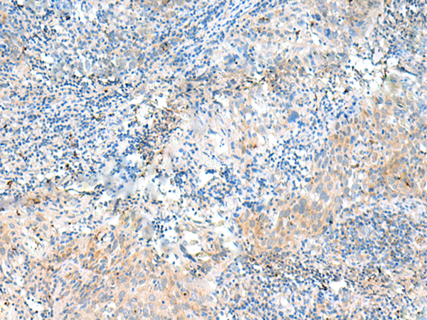 Rabbit Polyclonal Antibody to NID2