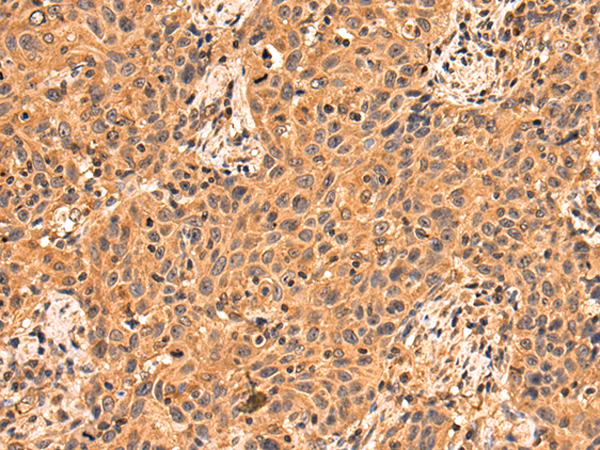 Rabbit Polyclonal Antibody to INPP4A
