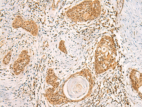 Rabbit Polyclonal Antibody to EFTUD2