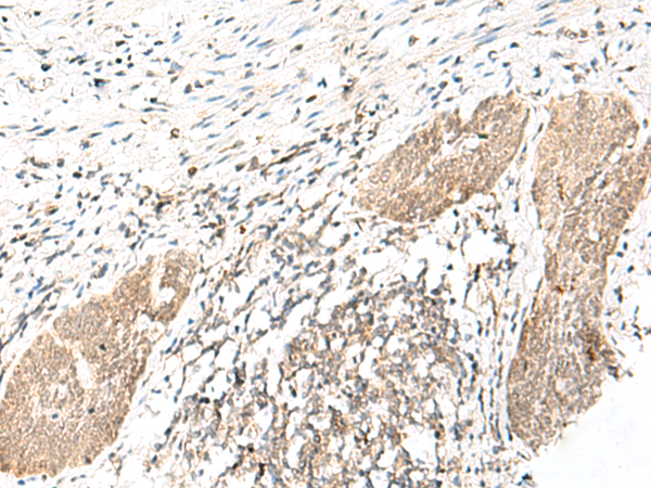 Rabbit Polyclonal Antibody to DHX36