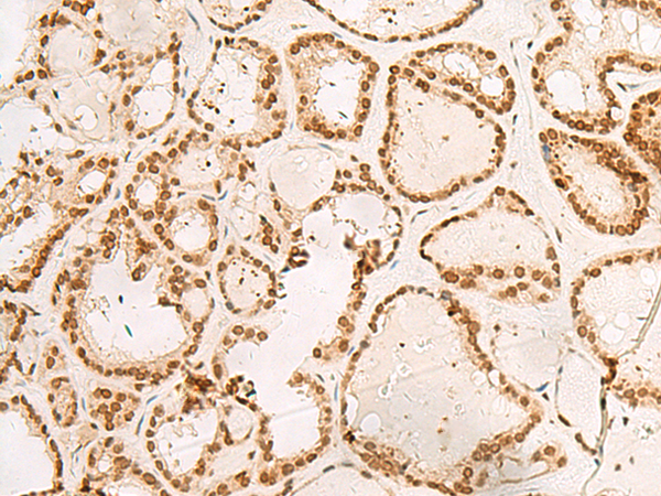 Rabbit Polyclonal Antibody to POM121