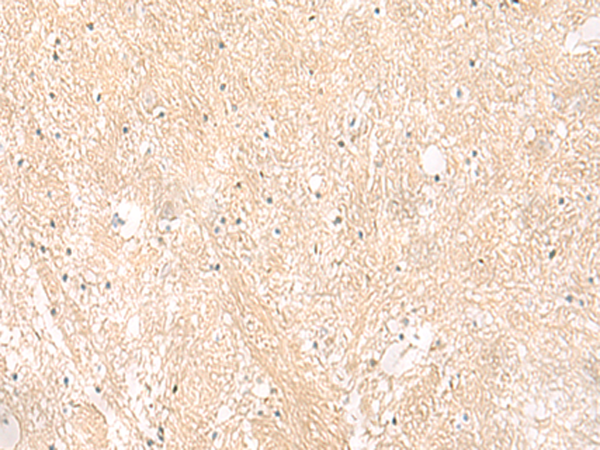Rabbit Polyclonal Antibody to EMC1