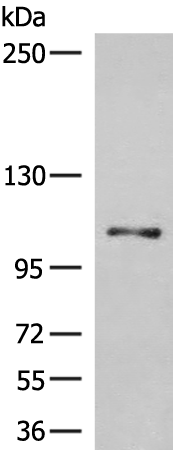 Rabbit Polyclonal Antibody to HPS3