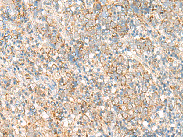 Rabbit Polyclonal Antibody to PSD4
