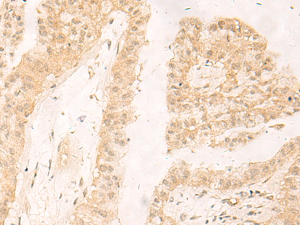 Rabbit Polyclonal Antibody to RBX1