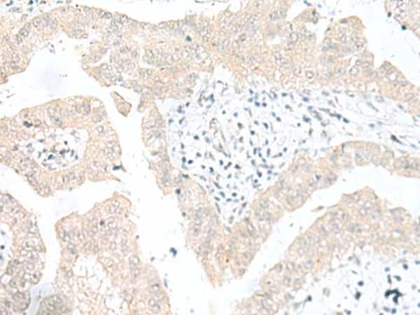 Rabbit Polyclonal Antibody to SNRPD1