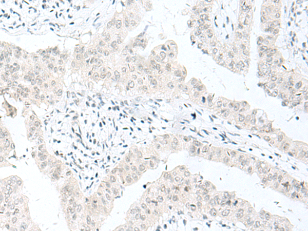 Rabbit Polyclonal Antibody to ENSA