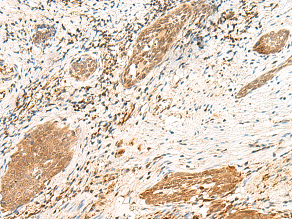 Rabbit Polyclonal Antibody to POLR1D