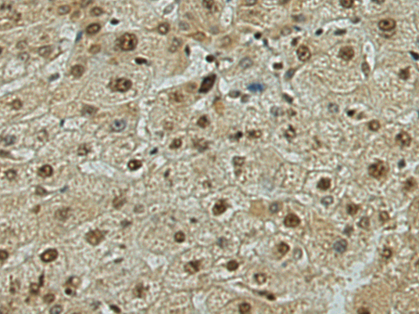 Rabbit Polyclonal Antibody to GLRX2
