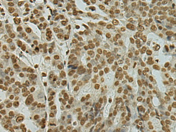 Rabbit Polyclonal Antibody to SUB1