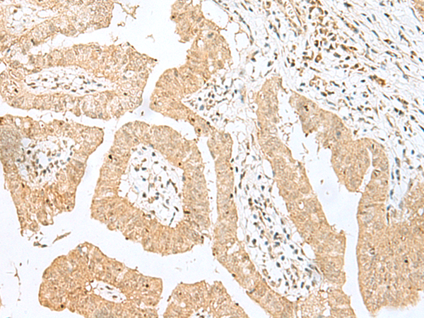 Rabbit Polyclonal Antibody to BEX2
