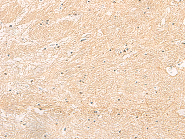 Rabbit Polyclonal Antibody to IFITM2