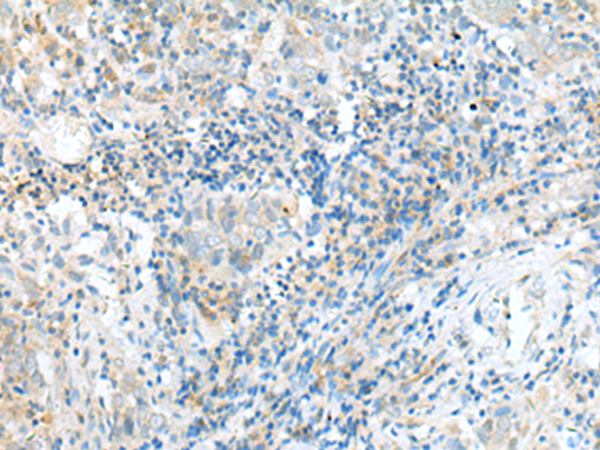 Rabbit Polyclonal Antibody to CPLX1