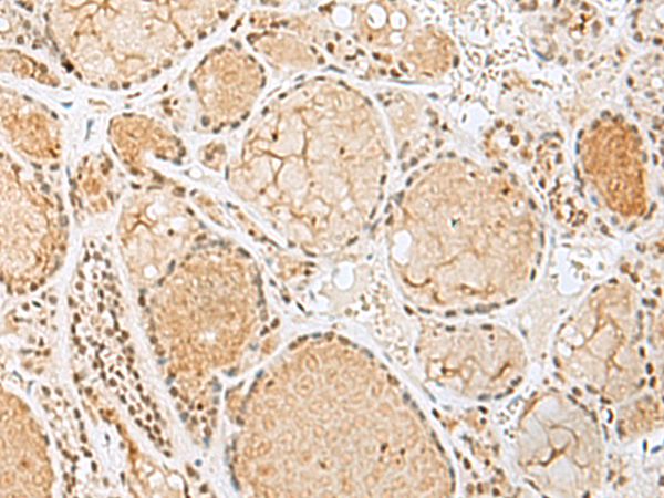 Rabbit Polyclonal Antibody to H2BC12