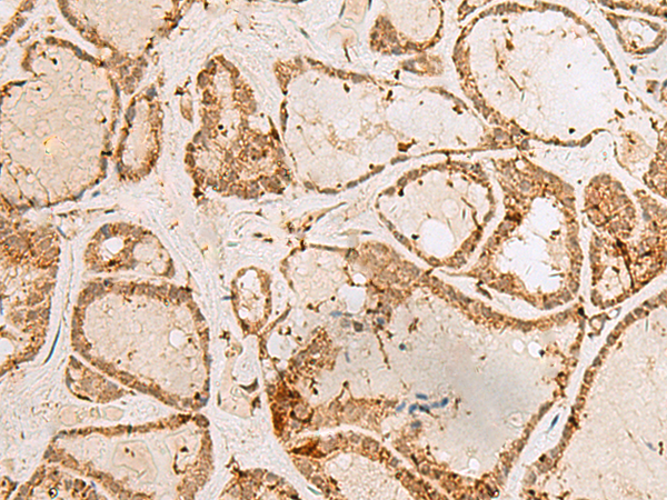 Rabbit Polyclonal Antibody to H3-3B