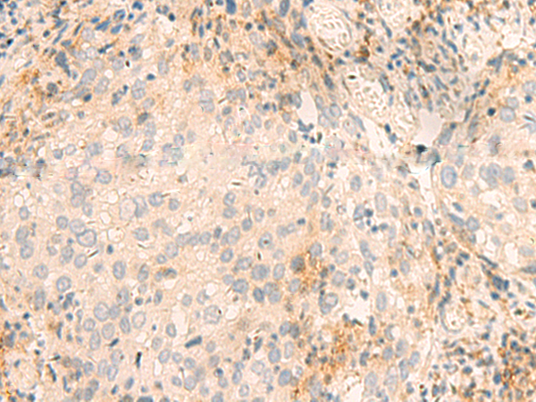 Rabbit Polyclonal Antibody to GSKIP