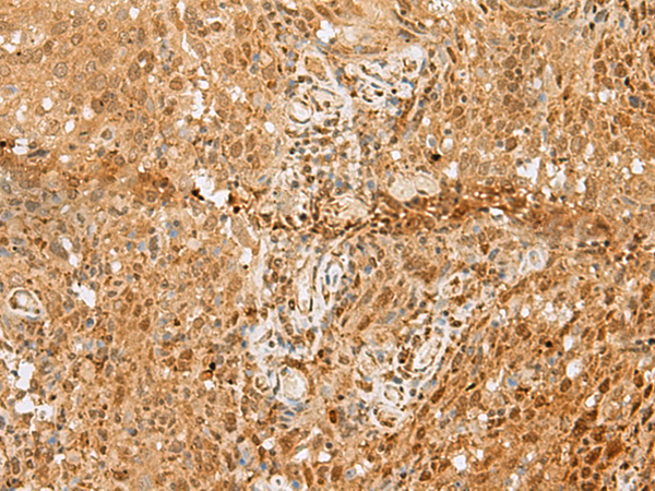 Rabbit Polyclonal Antibody to PNRC2