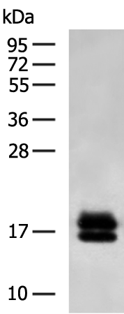 Rabbit Polyclonal Antibody to NPC2