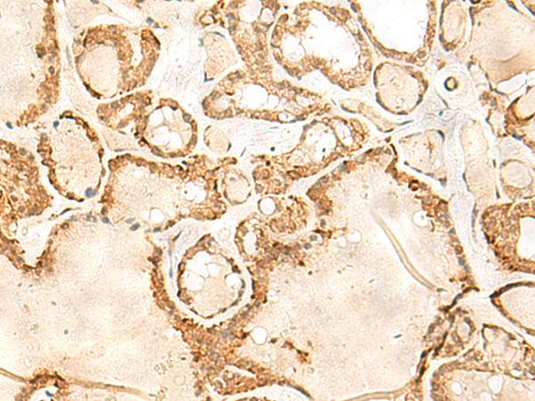 Rabbit Polyclonal Antibody to JPT1