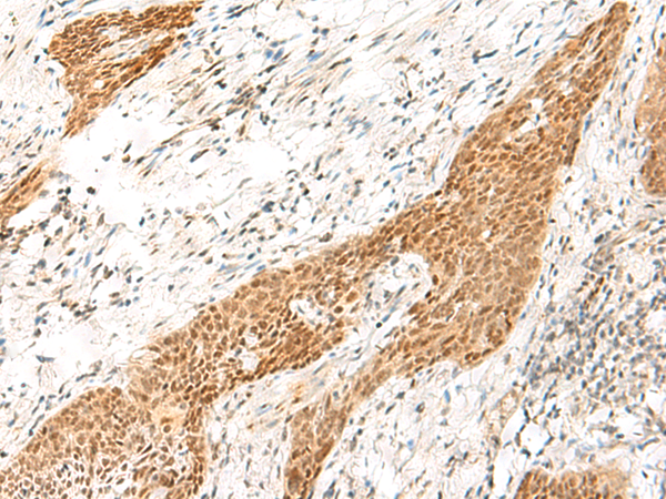 Rabbit Polyclonal Antibody to RPS27A