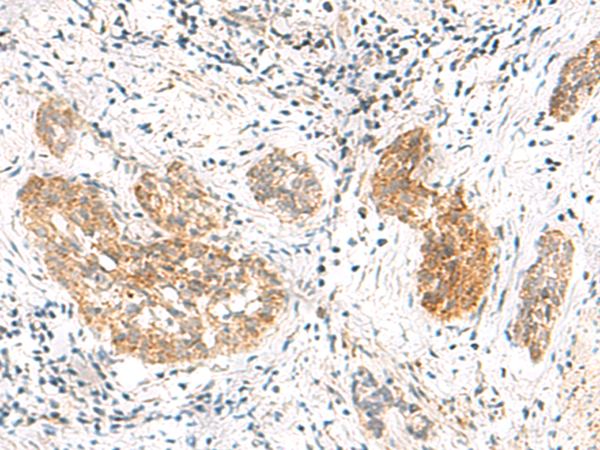 Rabbit Polyclonal Antibody to MRPL50