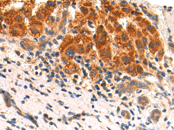 Rabbit Polyclonal Antibody to MKNK2