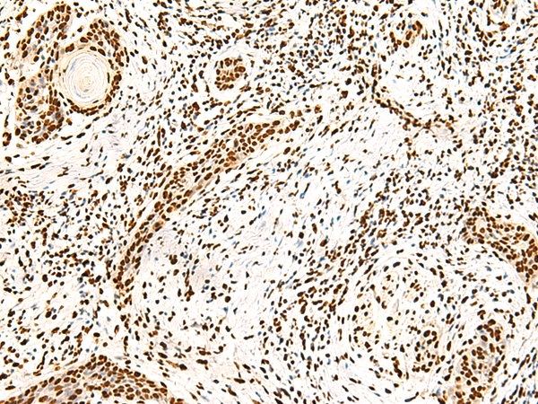 Rabbit Polyclonal Antibody to ILF3