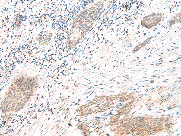 Rabbit Polyclonal Antibody to ARL2BP