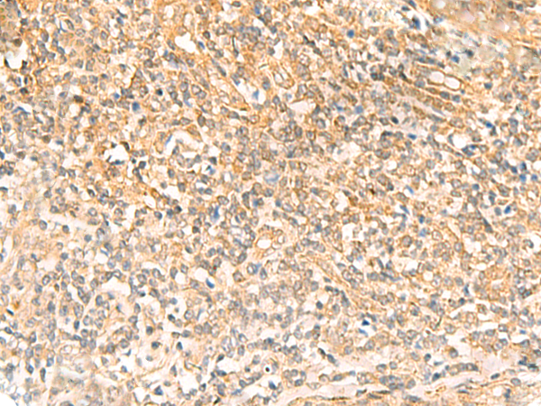 Rabbit Polyclonal Antibody to UBD