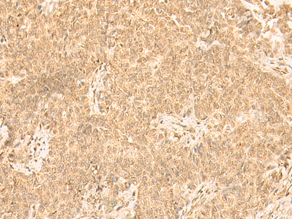 Rabbit Polyclonal Antibody to ST8SIA4