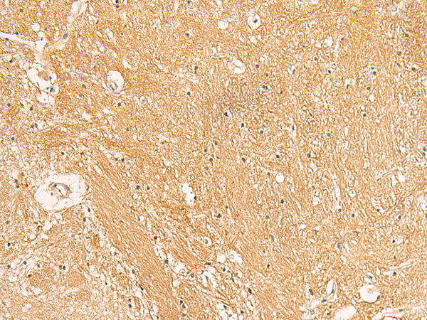 Rabbit Polyclonal Antibody to TXNDC12