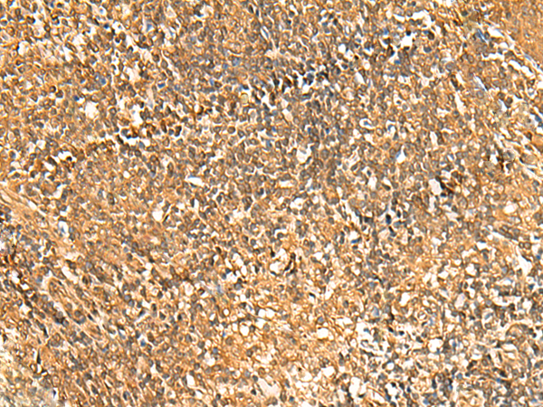 Rabbit Polyclonal Antibody to GSG1L