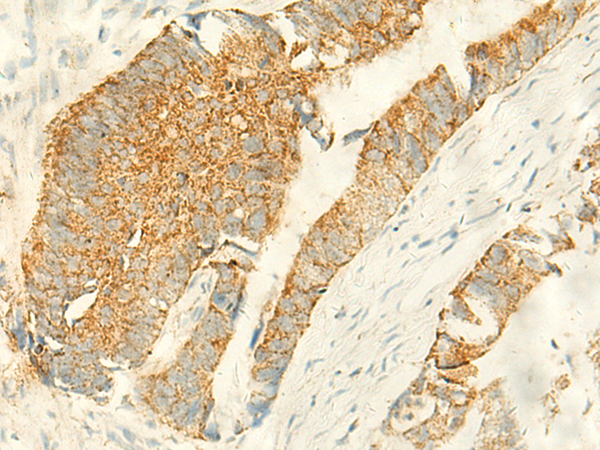 Rabbit Polyclonal Antibody to MPV17