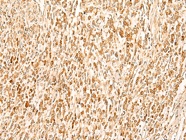 Rabbit Polyclonal Antibody to SMUG1