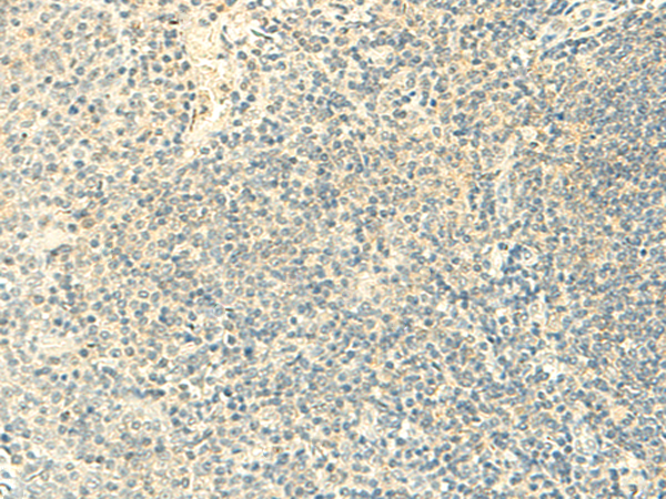 Rabbit Polyclonal Antibody to FMNL2