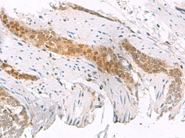 Rabbit Polyclonal Antibody to SCAND1