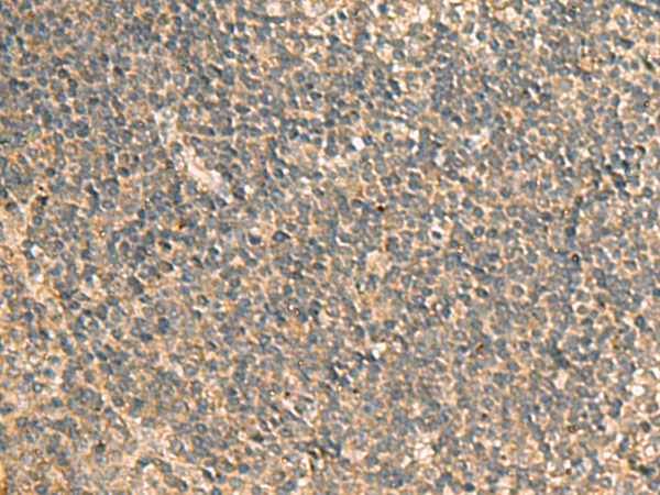 Rabbit Polyclonal Antibody to GPBP1