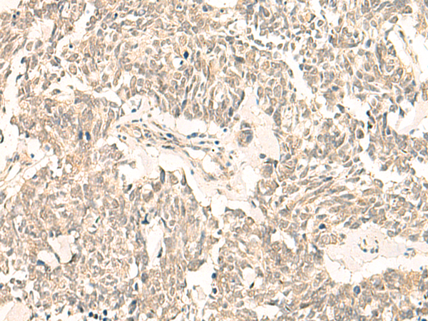 Rabbit Polyclonal Antibody to GINS2