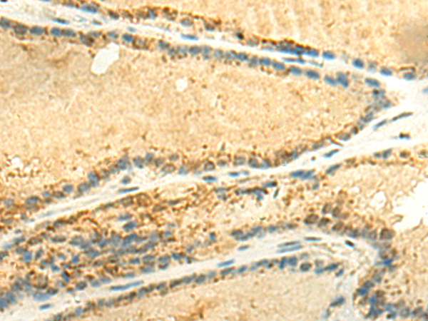 Rabbit Polyclonal Antibody to EEF1AKMT2