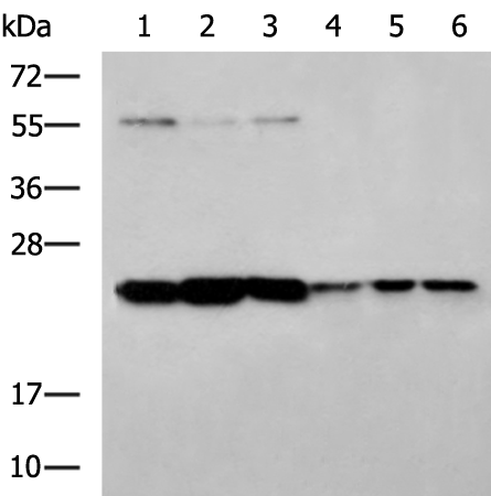Rabbit Polyclonal Antibody to PSMB2