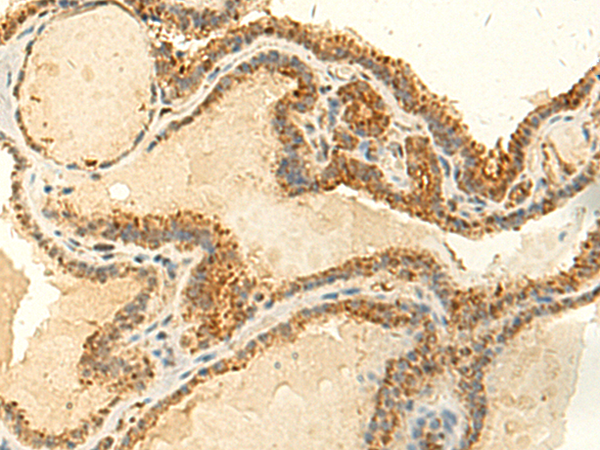 Rabbit Polyclonal Antibody to MTHFS
